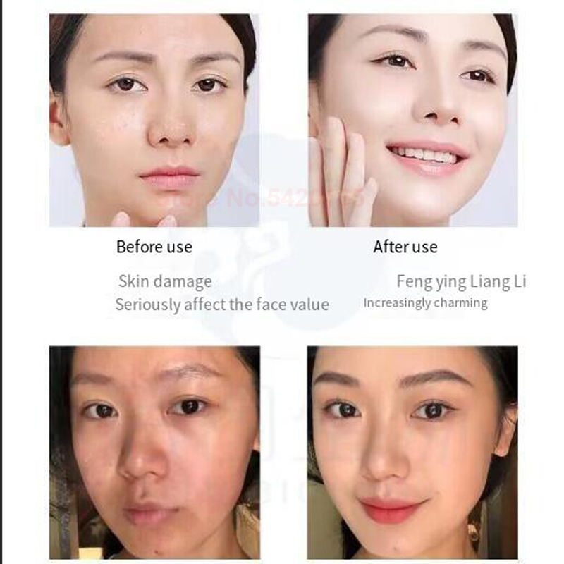 0.25 mm Microneedle GHK-Cu Blu - Epidermal Growth Factor review and price