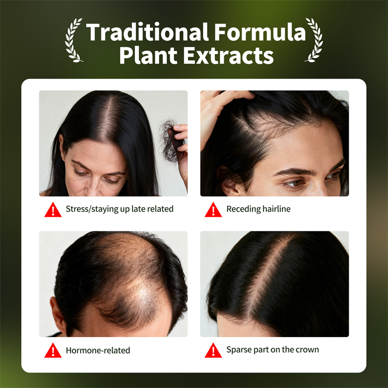 Natural Hair Growth Set Usman  - Epidermal Growth Factor review and price