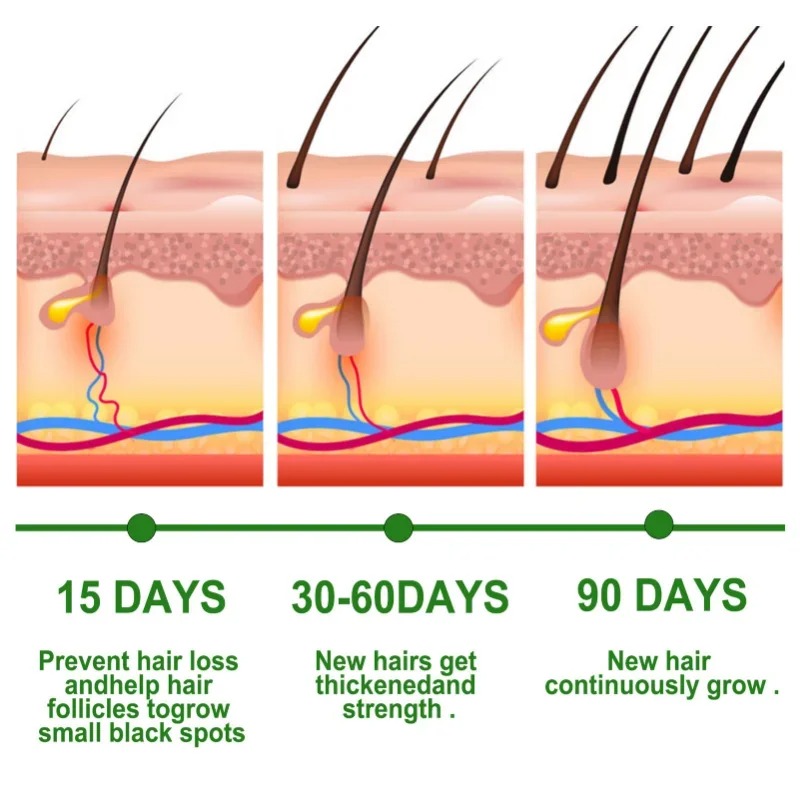 Hair Growth Serum Fast Growing - Epidermal Growth Factor review and price