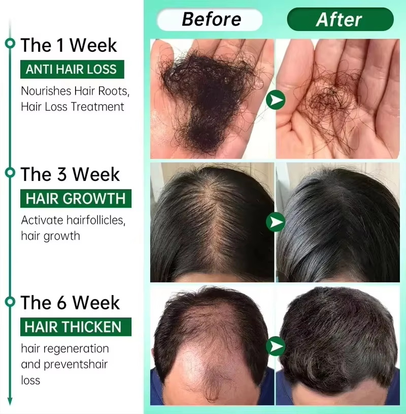Hair Growth Serum 7 Days Fast  - Epidermal Growth Factor review and price