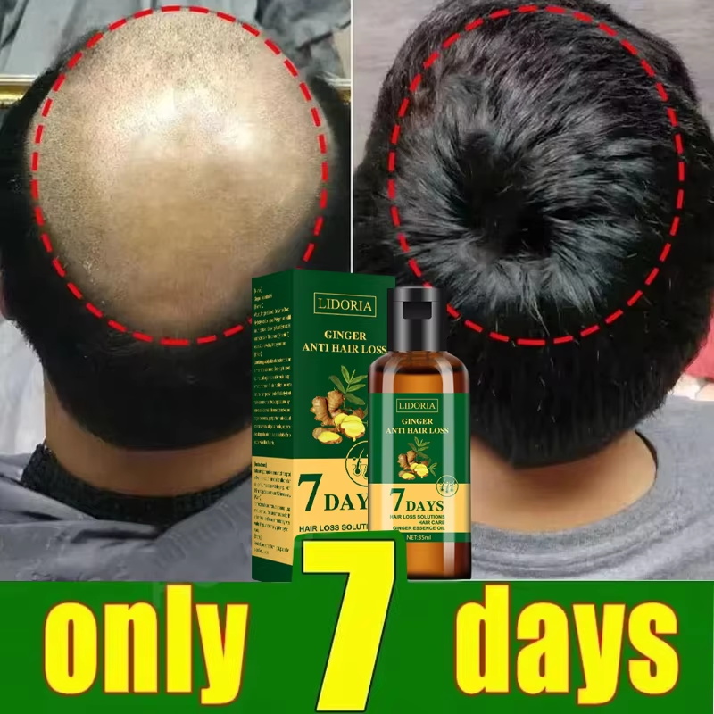 Hair Growth Serum 7 Days Fast  - Epidermal Growth Factor review and price