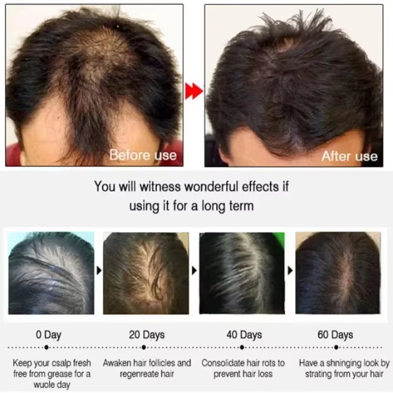 Hair Growth Serum 7 Days Fast  - Epidermal Growth Factor review and price