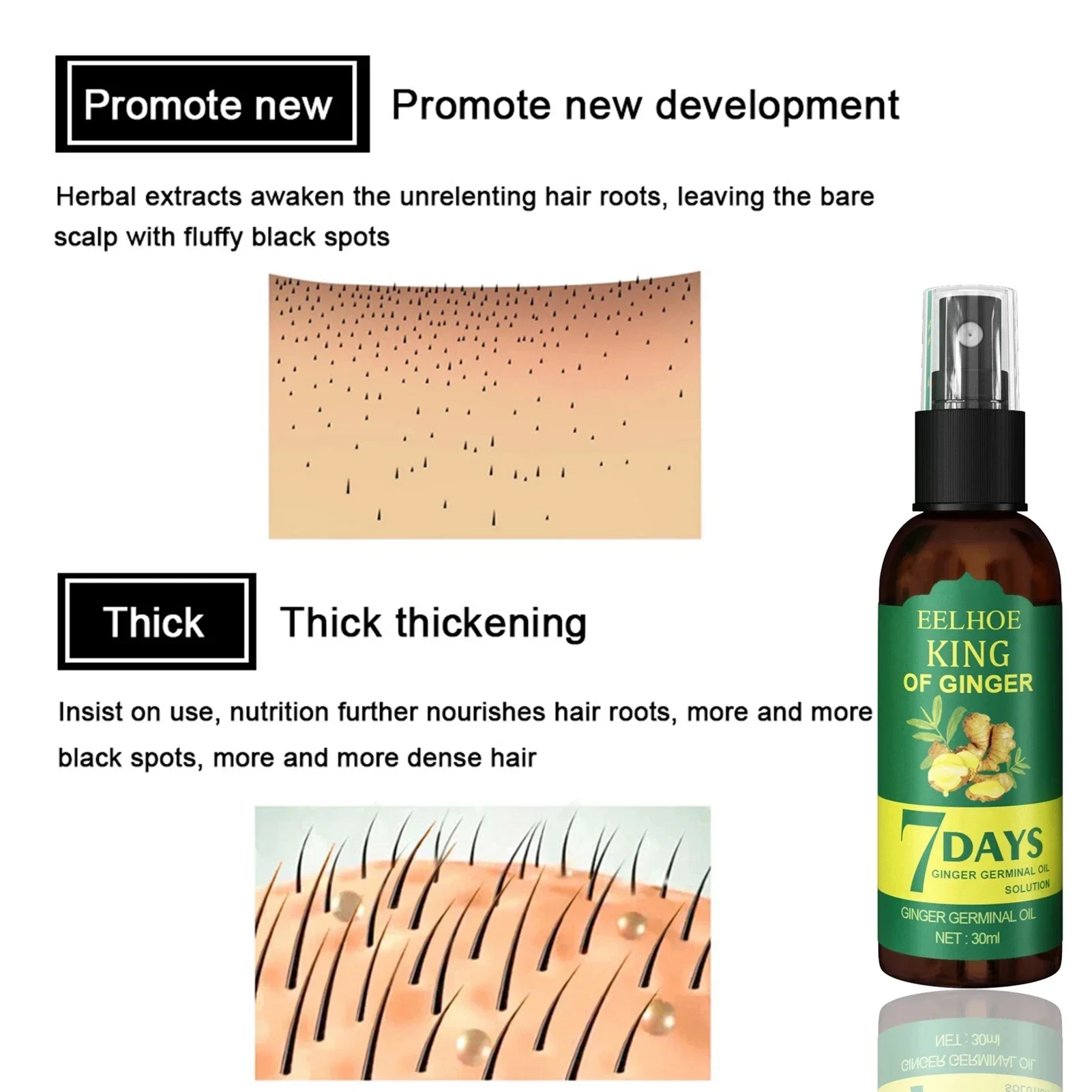 2024 Ginger Hair Growth Serum  - Epidermal Growth Factor review and price