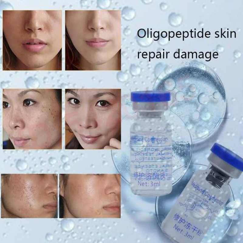 oligopeptide Freeze-dried Powd - Epidermal Growth Factor review and price